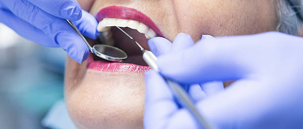 Best Emergency Dentist for Special Needs Patients in New London, IA